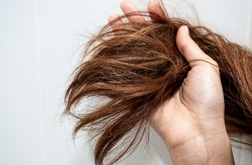 How to Prevent and Treat Hair Breakage?