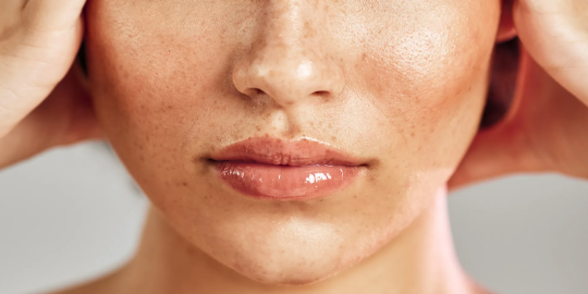 Effective Depigmenting Treatments for Even Skin Tone